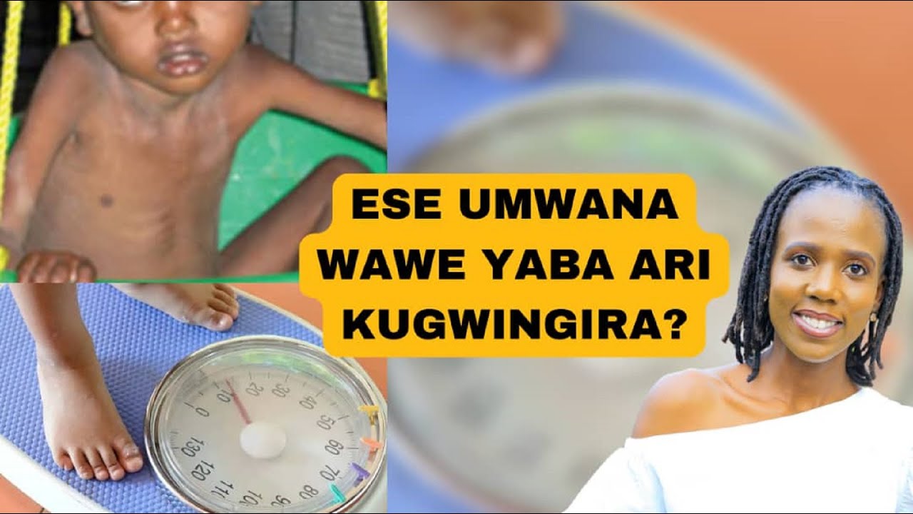 Ibimenyetso 5 biranga umwana uri gusatira igwingira/signs your child is underweight (and what to do)