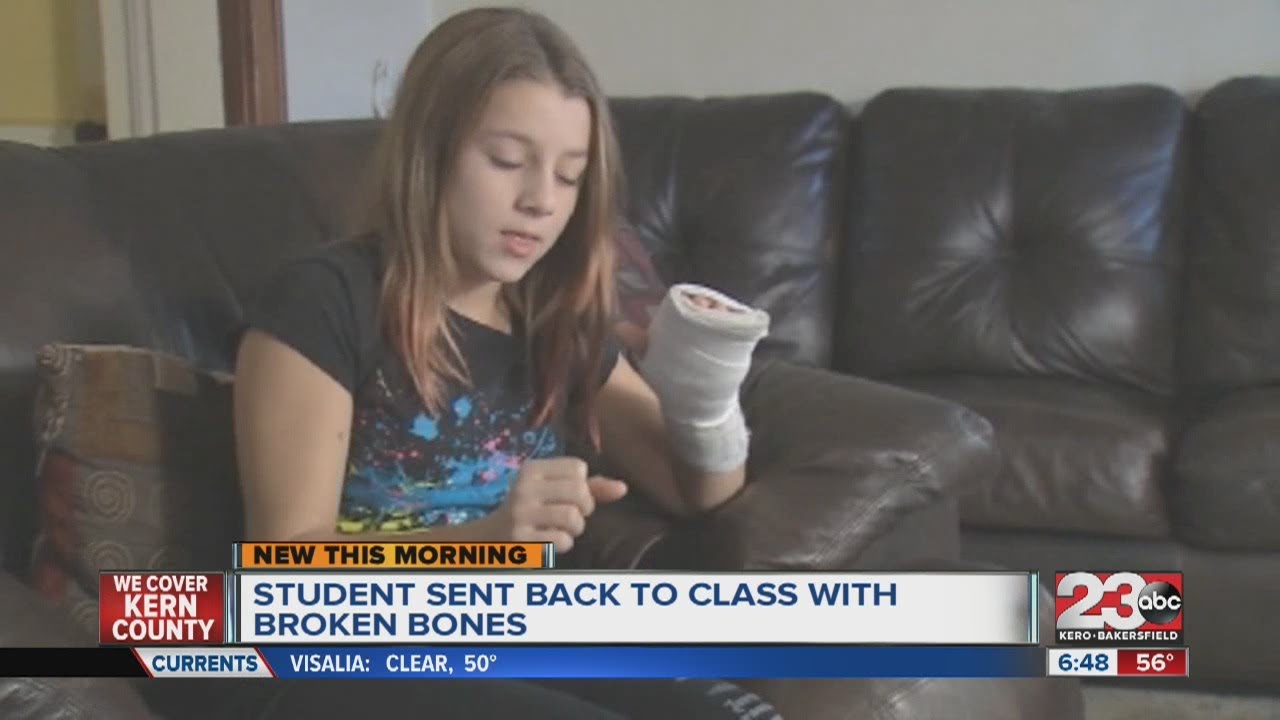 Student sent back to class with broken bones