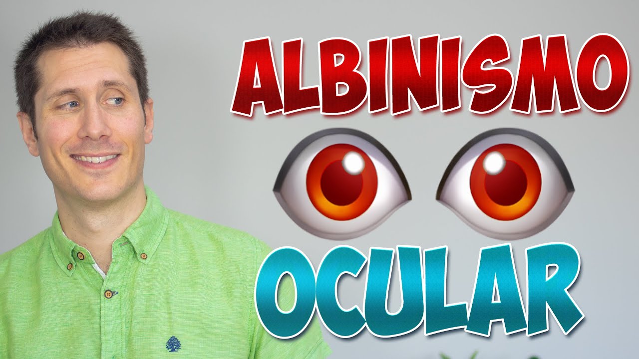🔴👀 Albinismo ocular - Una condición rara