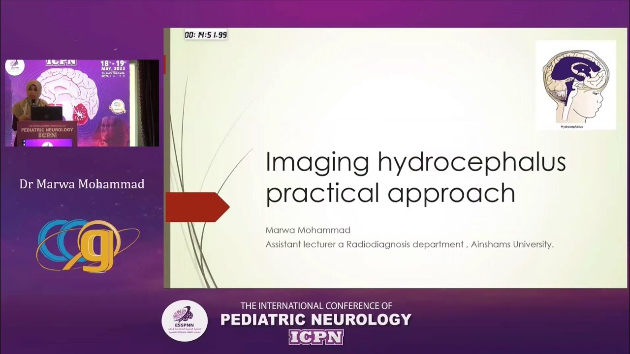 Imaging of Hydrocephalus practical approach Dr Marwa Mohamed