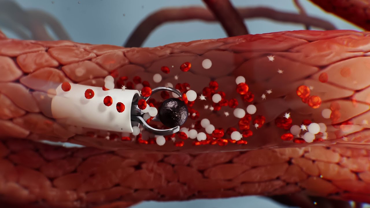 Microrobots for targeted drug delivery
