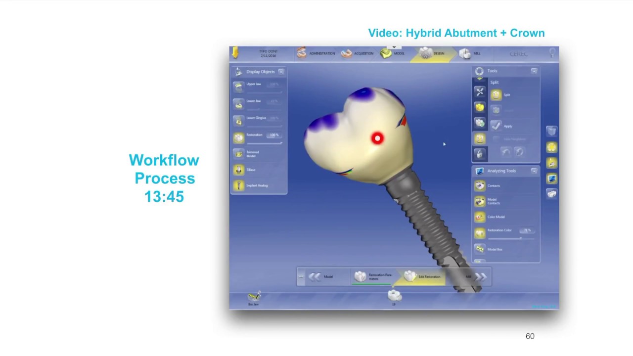 Серия лекций CEREC TiBase, Урок 04
