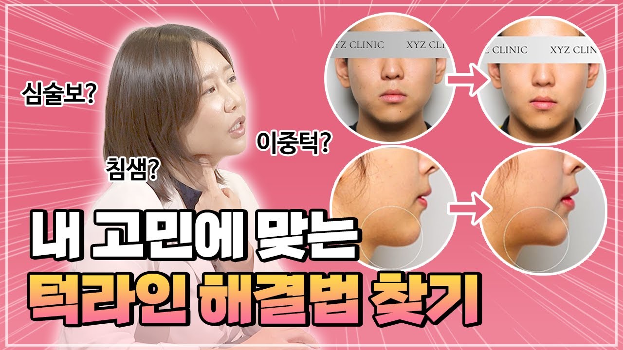 잃어버린 턱라인, 나에게 맞는 원인과 해결법은?🔍 ㅣ은혜로운 의사생활