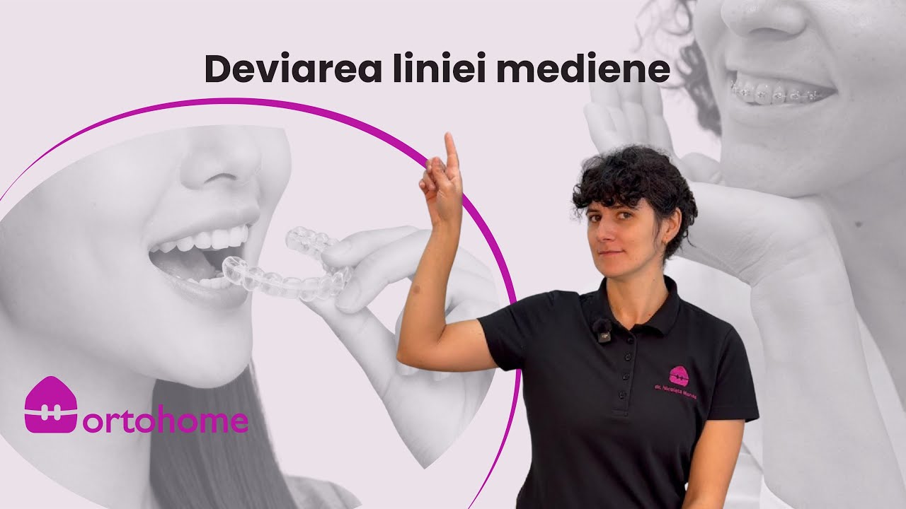 Deviarea liniei mediene: de ce zâmbetul nu este pe centru și cum se corectează