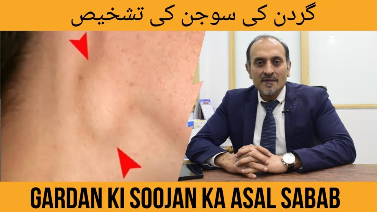 Neck swelling diagnosis