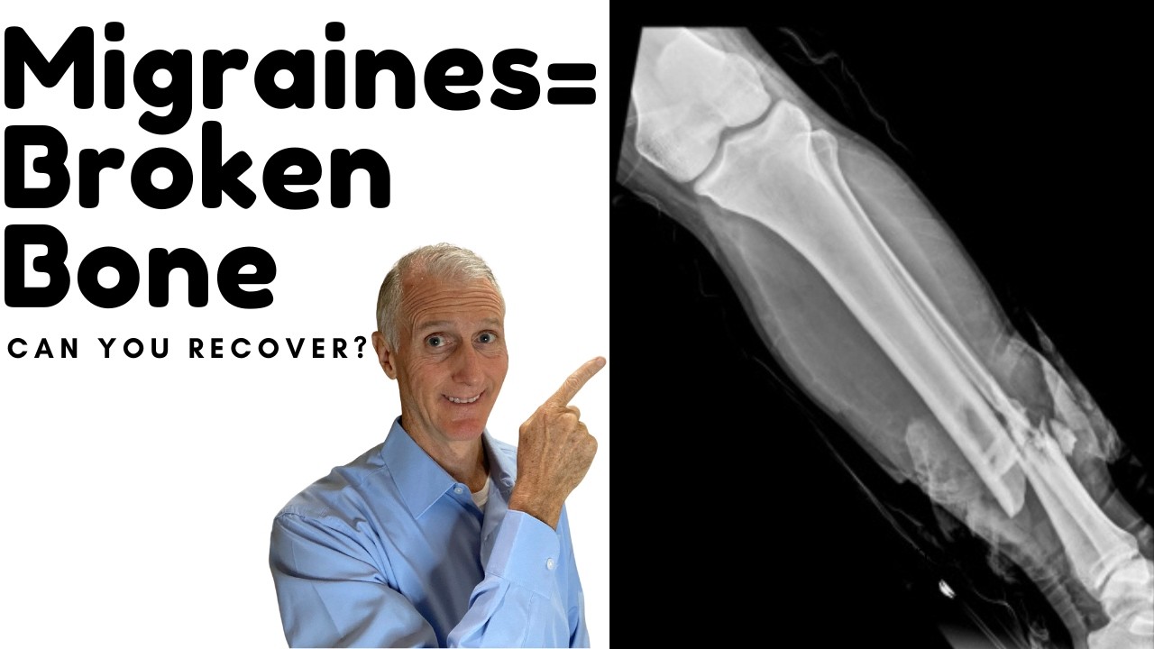 Migraine Recovery = Broken Bone Recovery