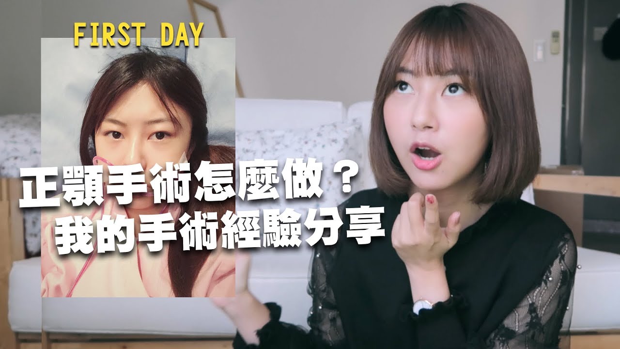 正顎手術怎麼做？手術經驗分享｜術後腫臉照大公開