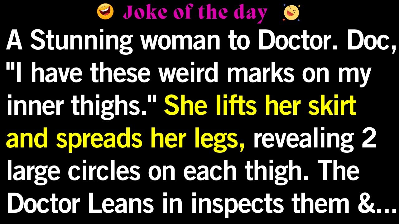😂 Mystery Marks and a Girlfriend’s Secret Revealed #loljokes  #jokes #humor