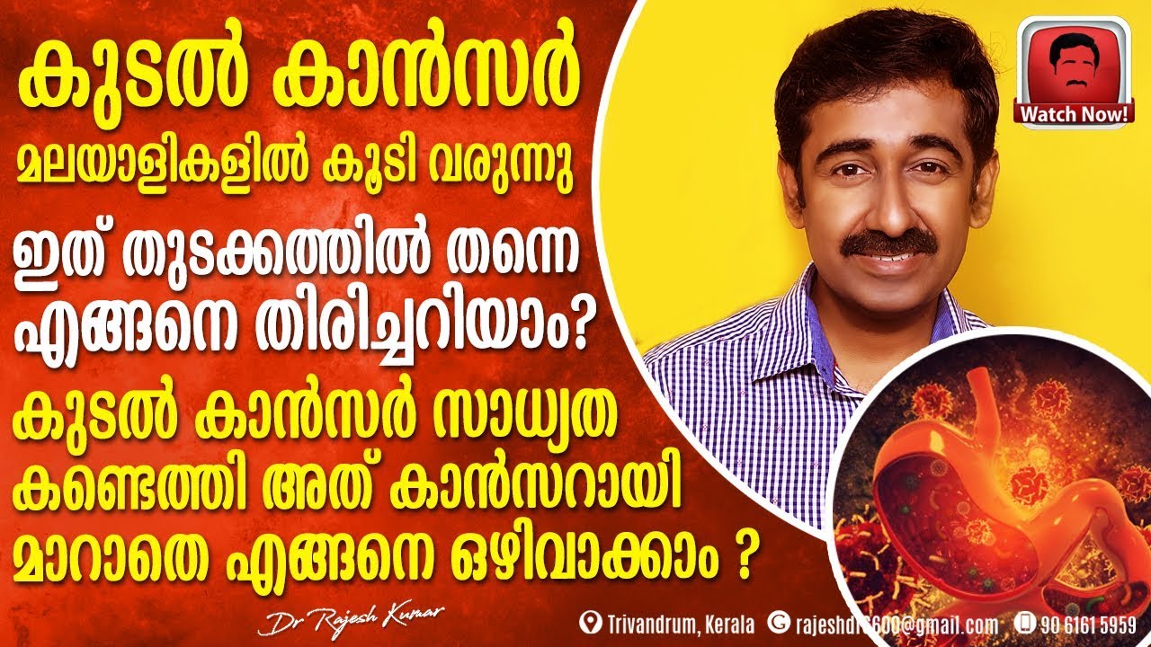 കുടലിൽ കാൻസർസാധ്യത കണ്ടെത്തി അത് കാൻസറായി മാറാതെ എങ്ങനെ ഒഴിവാക്കാം ? പ്രധാനപ്പെട്ട ഇൻഫർമേഷൻ