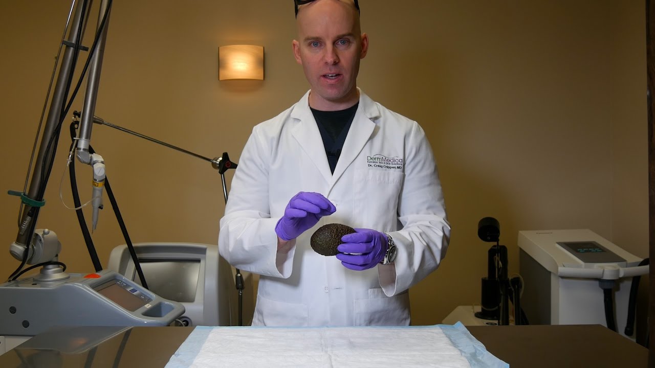 Pearly Penile Papules Removal in Canada | 4K