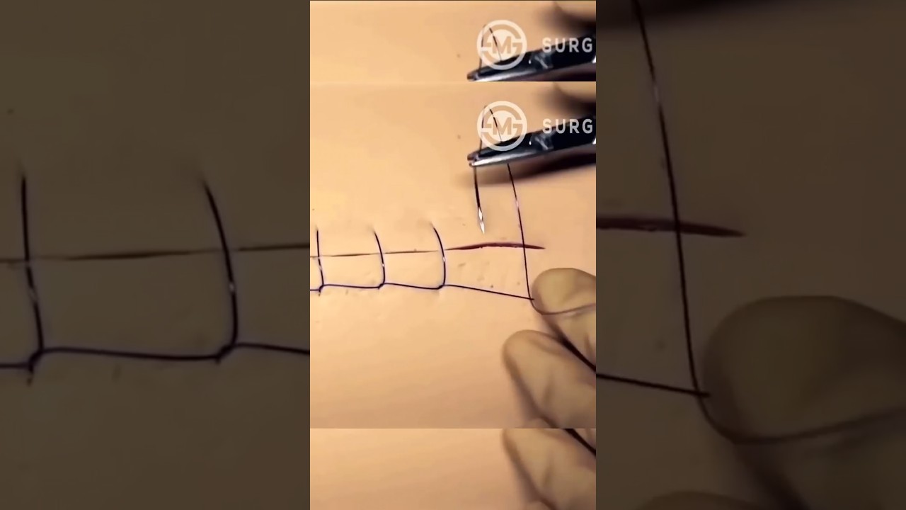 Voc&ecirc; j&aacute; viu essa sutura? #medico #enfermagem  #sutura #shorts  #curiosidades