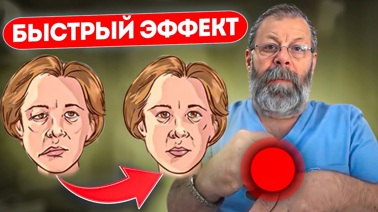 ➡️ПОКАЗЫВАЮ КАК БЫСТРО ВЫЛЕЧИТЬ ЛИЦЕВОЙ НЕРВ 4 ТОЧКАМИ
