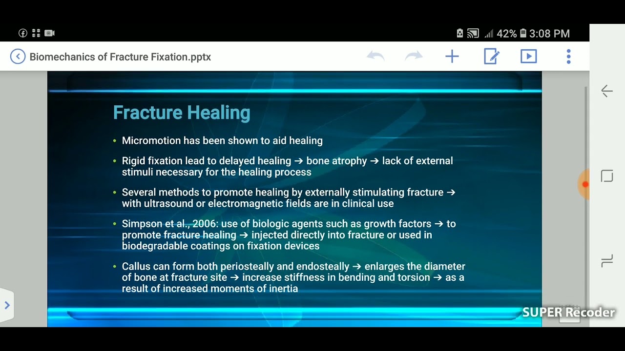 Applied Biomechanics Of fracture fixation susan j hall #mjee369 #dpt
