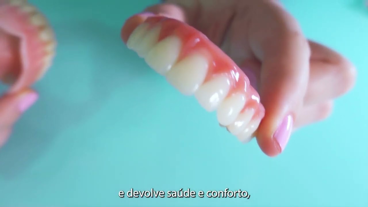dentes fixos em Gaspar