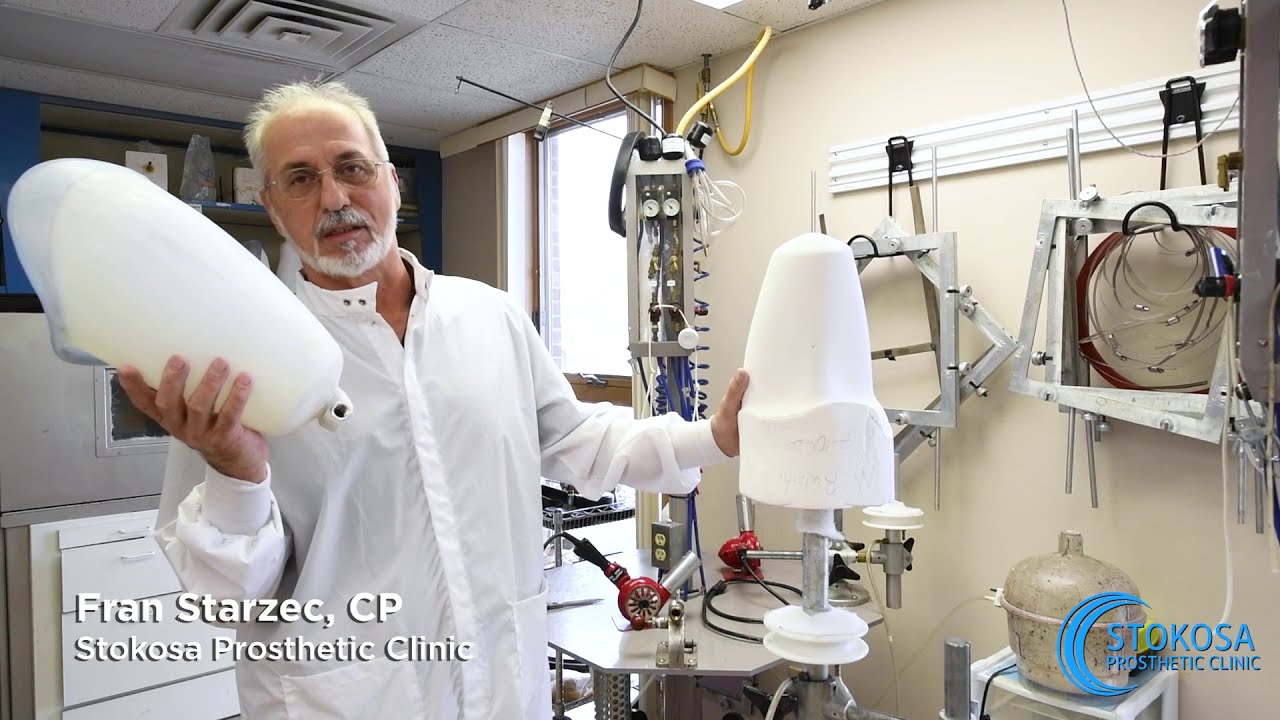 Adjustment Appointment | Volume Reduction | Stokosa Prosthetic Clinic