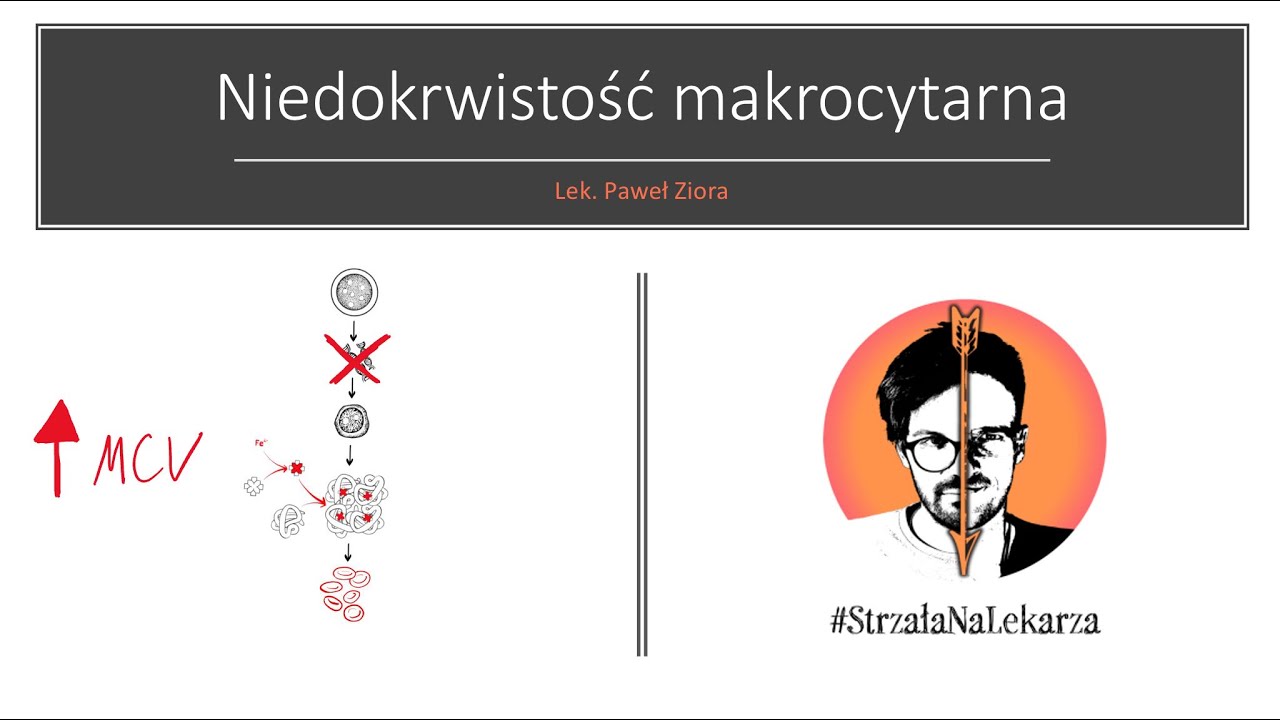 Niedokrwistość makrocytarna