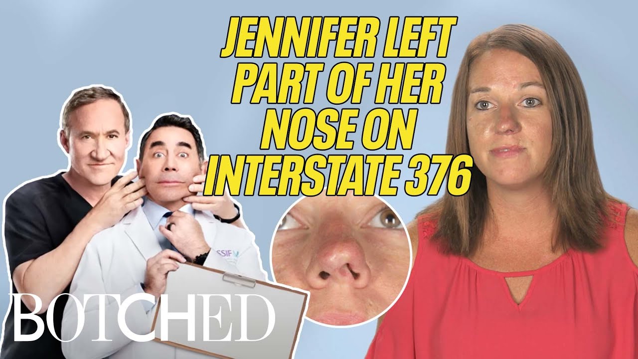 Jennifer przeżyła wypadek samochodowy, w kt&oacute;rym została przeciągnięta na dystansie 175 jard&oacute;w (przed i po) | Botched | E!