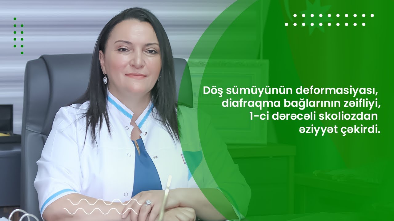 Döş sümüyünün deformasiyası, diafraqma bağlarının zəifliyi, 1-ci dərəcəli skolioz aşkar olundu.