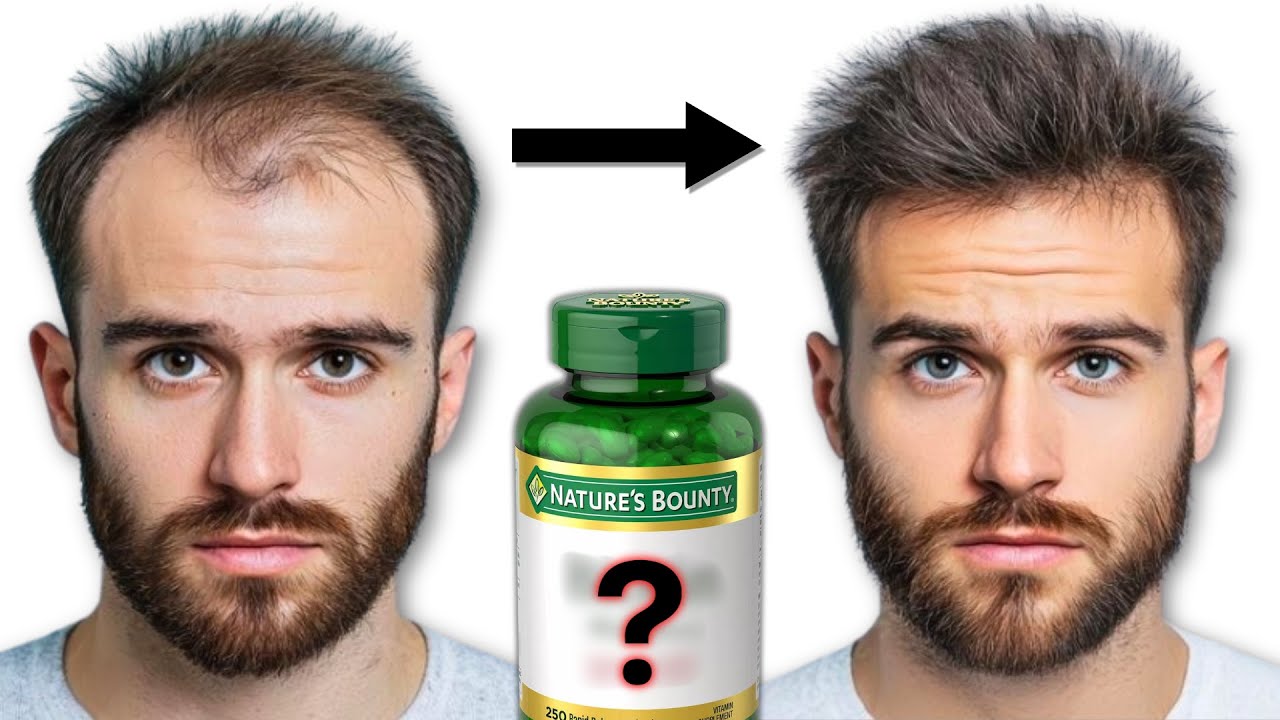 The ONLY Hair Loss Supplements You Need (See Results in 30 Days)