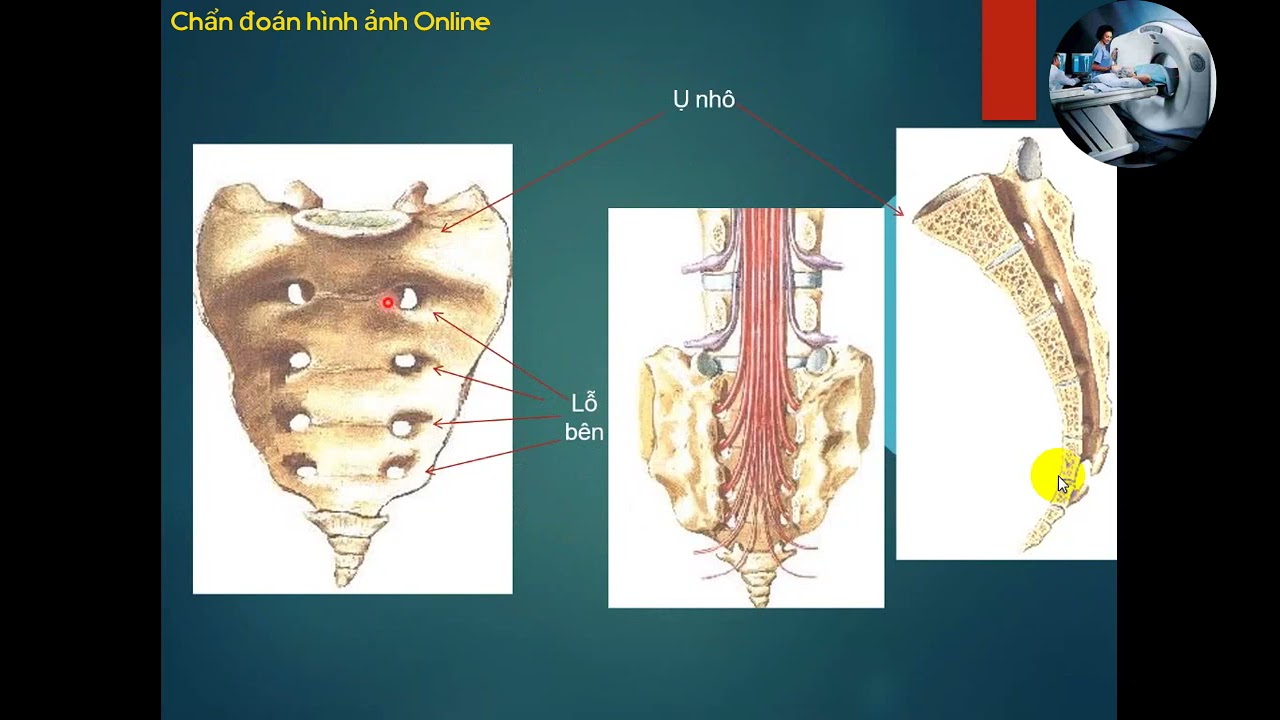 CT - MRI CỘT SỐNG