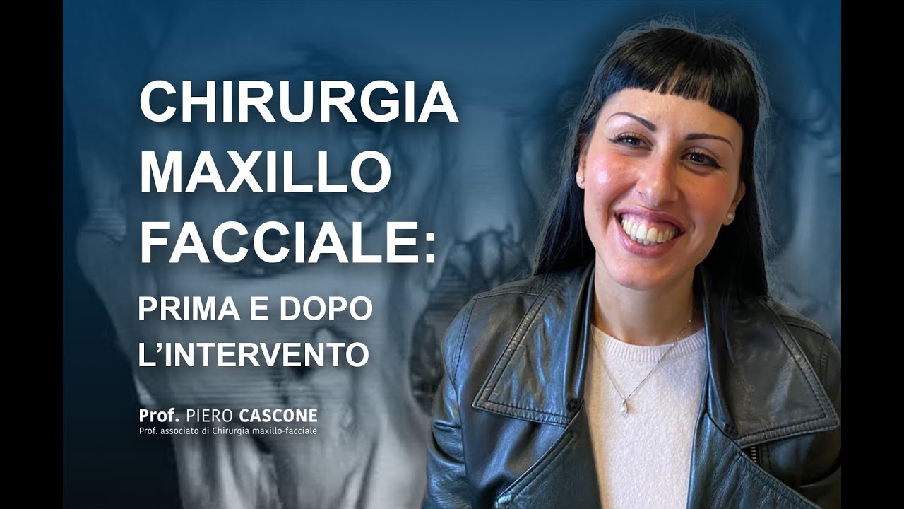Prima e Dopo l'intervento di chirurgia maxillo facciale