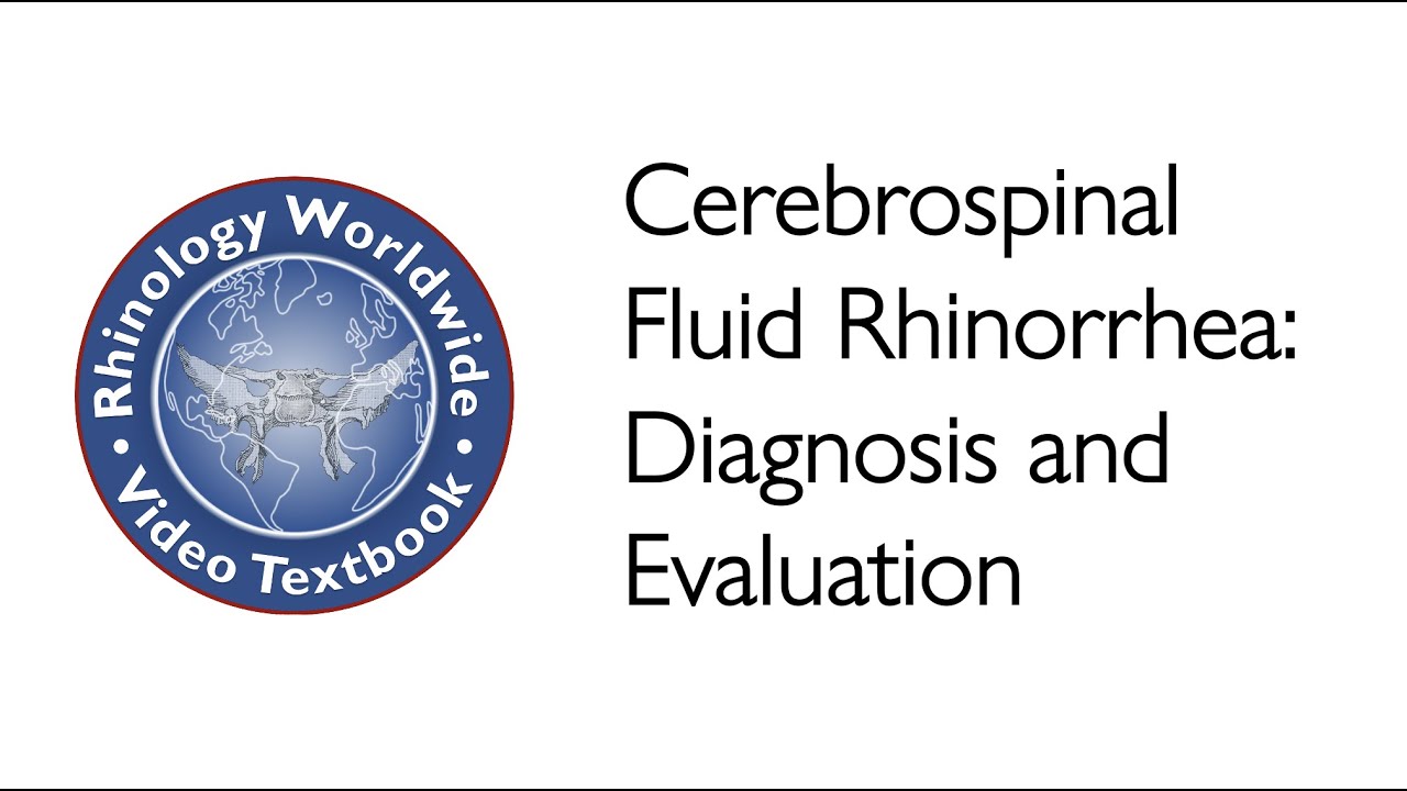 Cerebrospinal Fluid Rhinorrhea: Diagnosis and Evaluation - Dr. Donald Lanza and Dr. Alla Solyar
