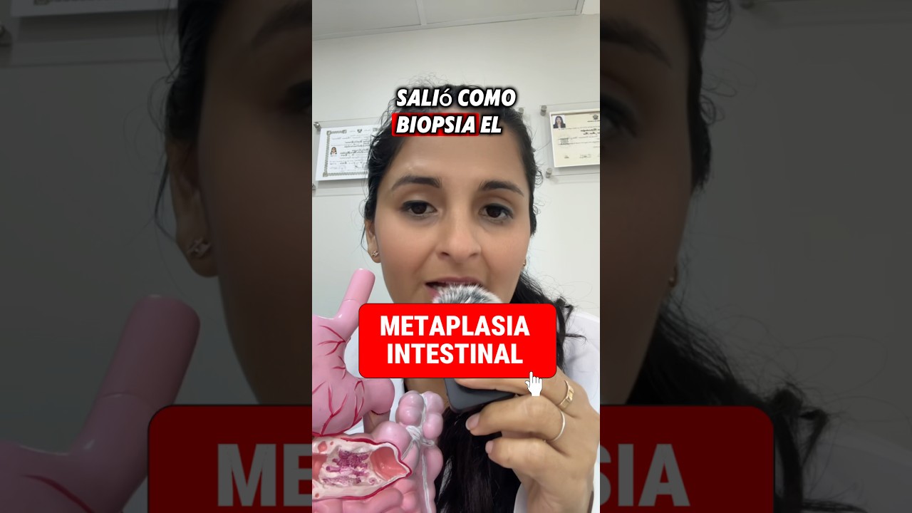 La metaplasia amerita seguimiento, NO ES C&Aacute;NCER #metaplasia #cancer #gastritis #endoscopia
