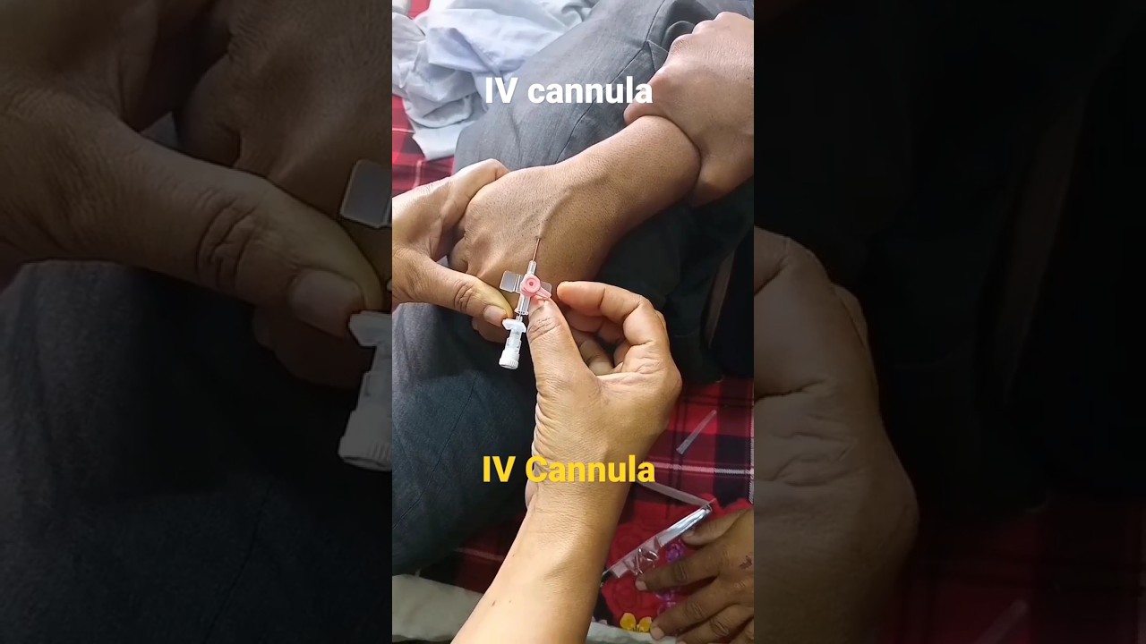 How to open IV channel How to insert Intravenous IV cannula at Hospital during nursing practice BD