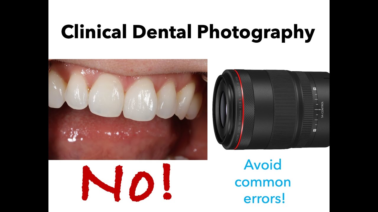 Dental Photography: 3 Tips for Excellent Anterior Images   HD 1080p