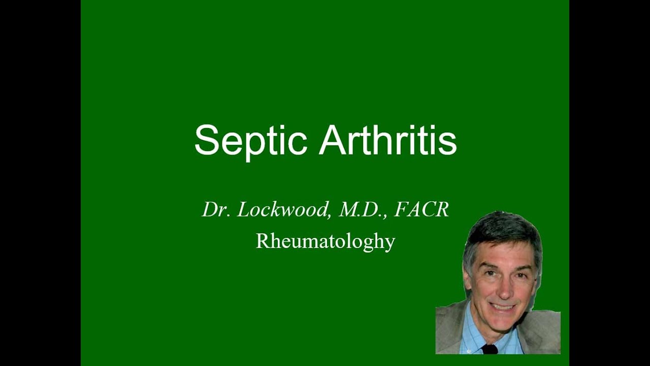 11 Septic (Infectious) Arthritis