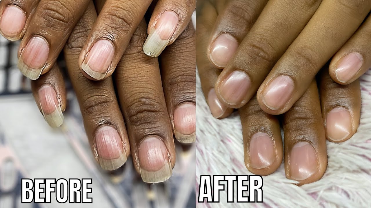 ASMR Cuticle/Nail Prep | EXTREMELY Satisfying Nail Transformation | Nail Cleaning | LoFi Chill Beats