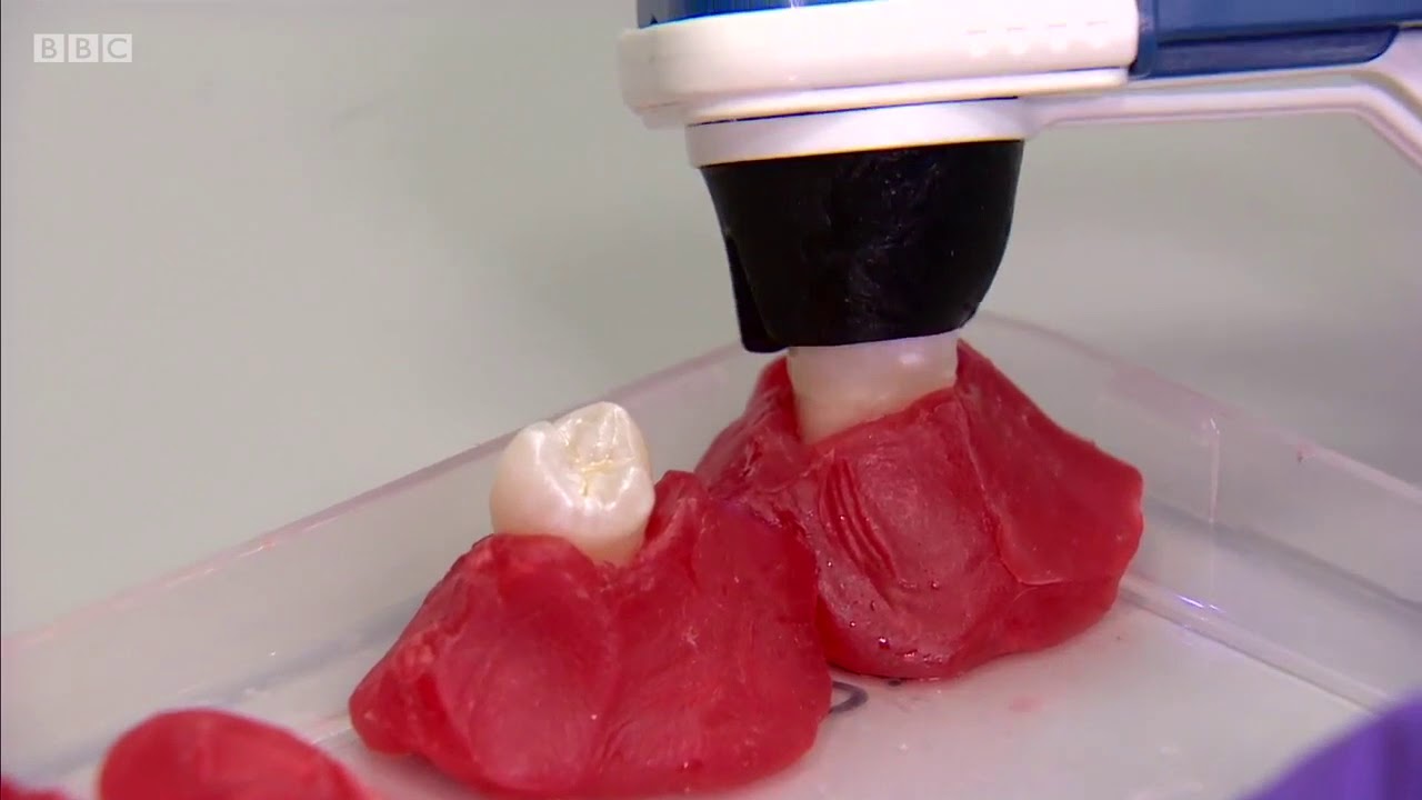 Calcivis Imaging System - The Power of Preventive Dentistry