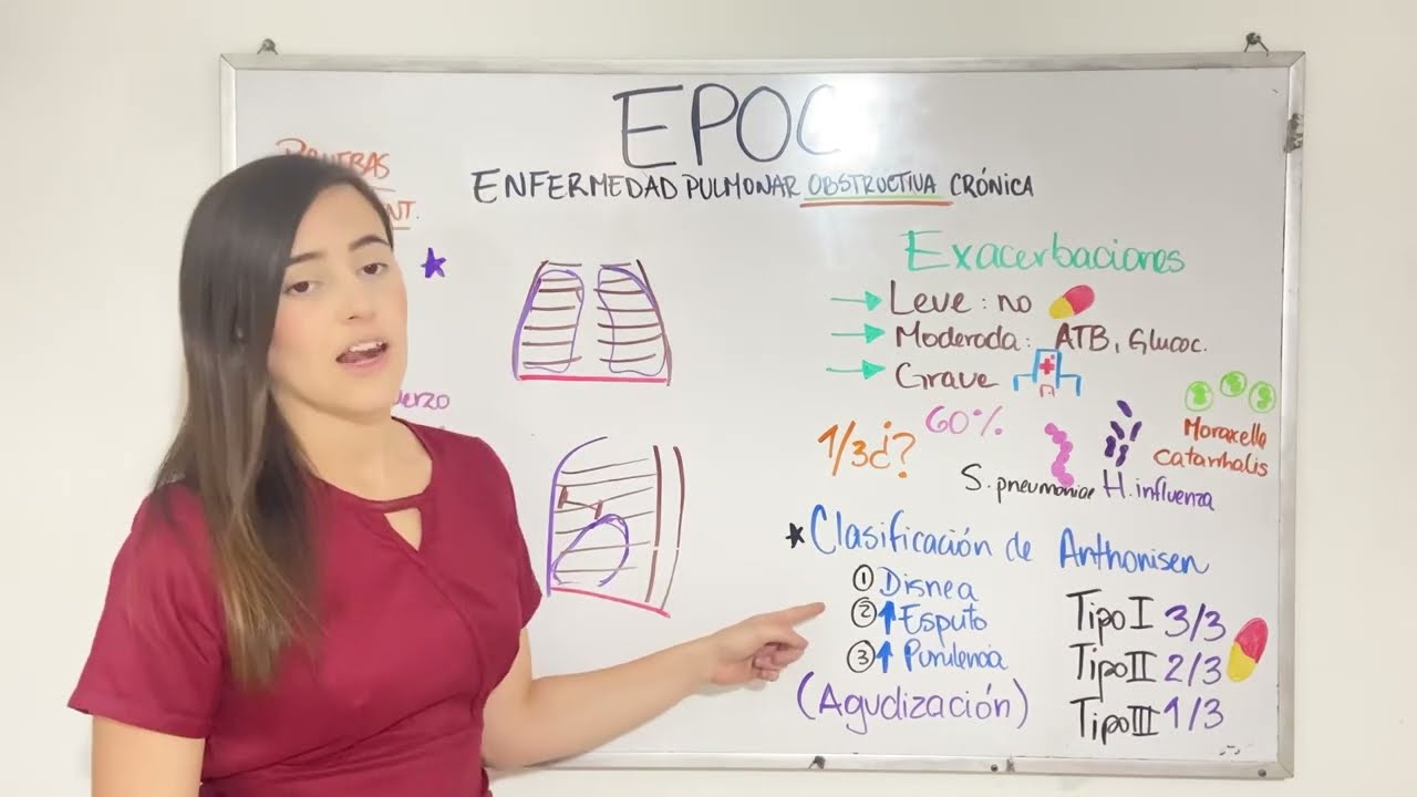 EPOC parte 2 - FISIOPATOLOGIA; signos y síntomas, diagnóstico y tratamiento