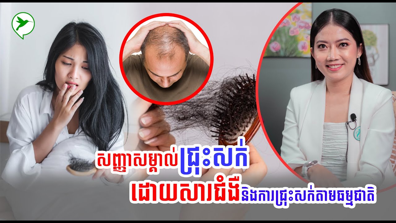 សញ្ញាសម្គាល់ជ្រុះសក់ដោយសារជំងឺនិងការជ្រុះសក់តាមធម្មជាតិ / Beauty Charm