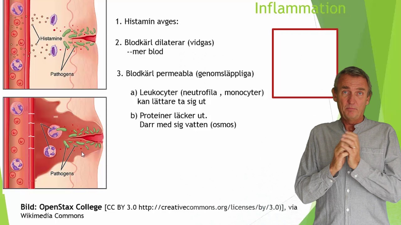 Immunförsvaret del 4(7) inflammation