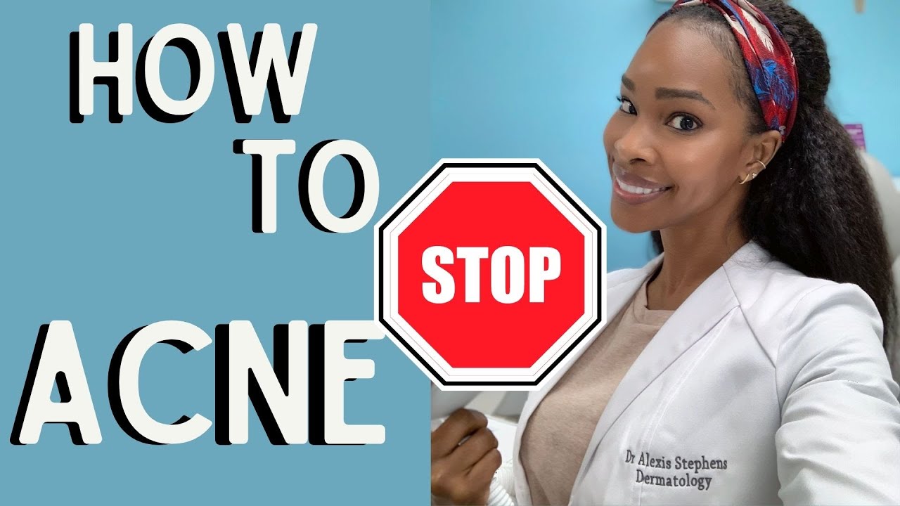 WHY YOU CANT GET RID OF ACNE