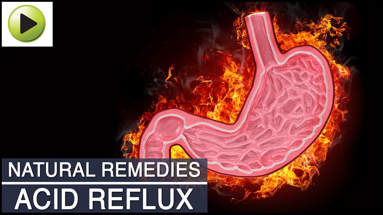 Acid Reflux (Acidity) - Natural Ayurvedic Home Remedies