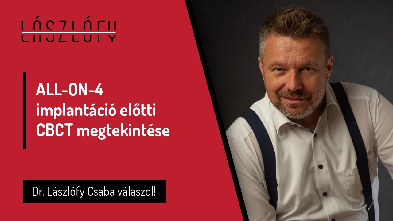 ALL-ON-4 (ALLON4) implantáció előtti CBCT megtekintése