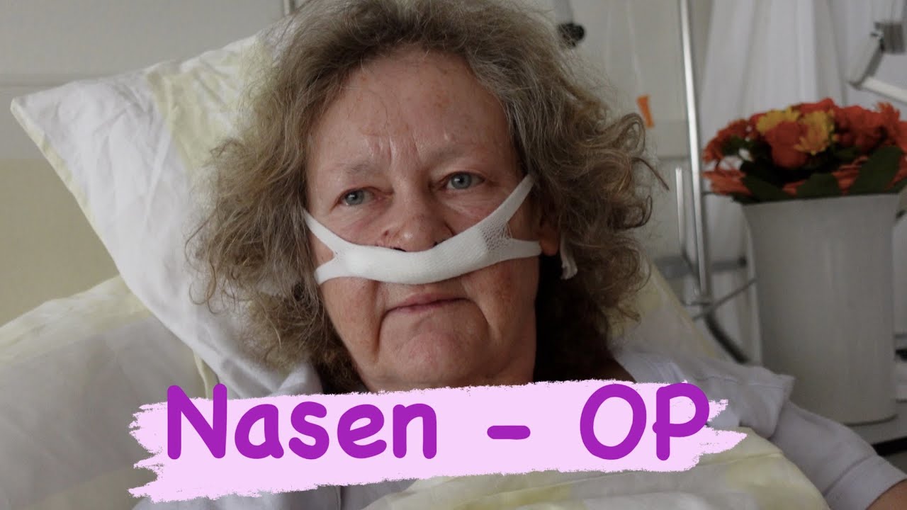 NASEN - OP: Mein OPERATIONS - VLOG