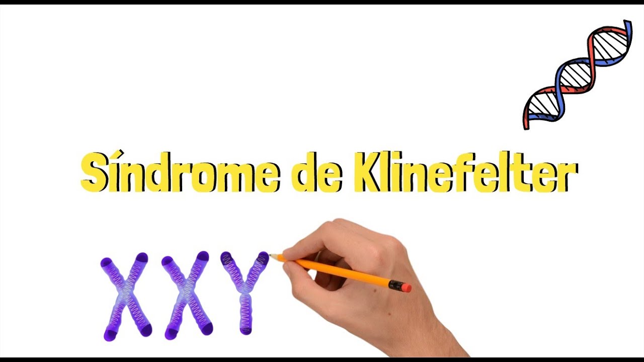 Síndrome de Klinefelter | Ilustrando Saúde