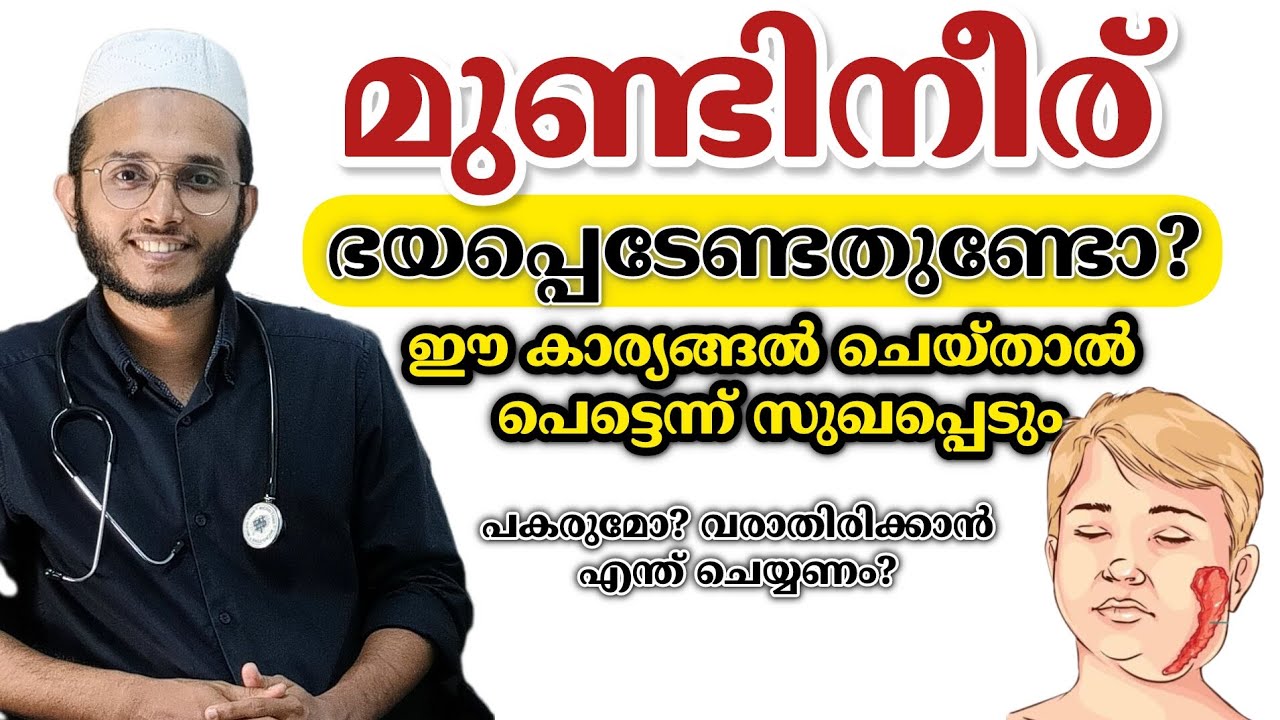 മുണ്ടിനീര് (mumps) ലക്ഷണങ്ങൾ, കാരണങ്ങൾ, എങ്ങനെ തടയാം Dr. Muhammed Shibili
