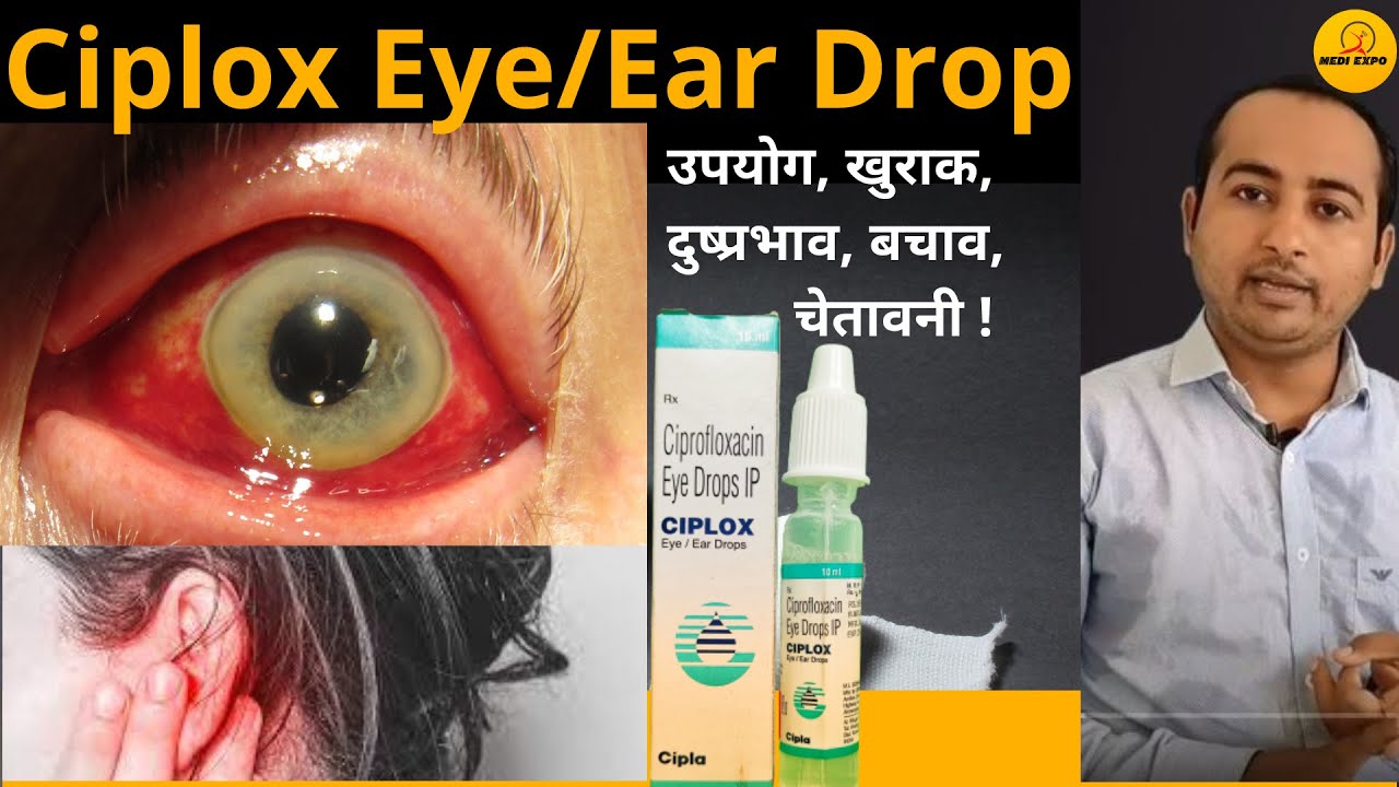 Ciplox Eye/Ear Drops Hindi | Ciplox Drop | Ciplox | uses, dose | उपयोग, खुराक, दुष्प्रभाव, चेतावनी