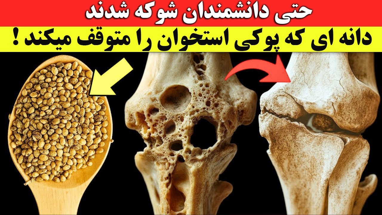 حتی دانشمندان شوکه شده اند !‌ دانه ای که پوکی استخوان را متوقف می کند