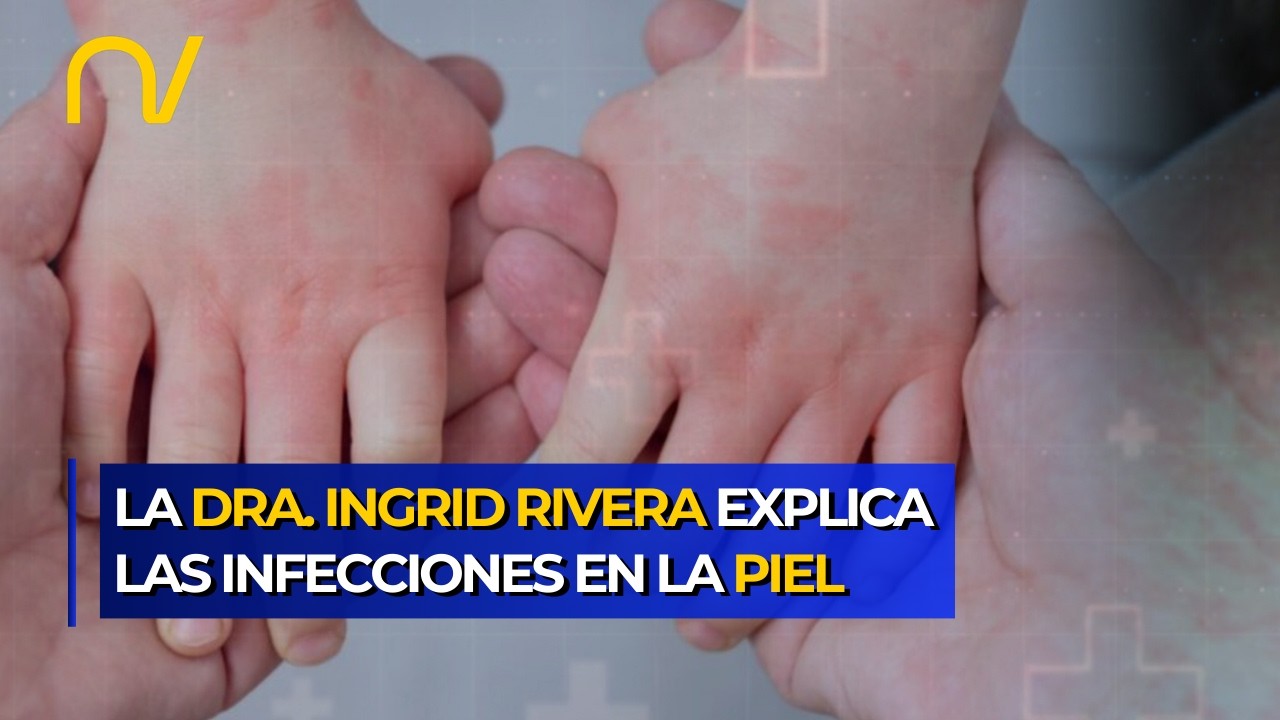 Piel sana, niños felices: Guía práctica de la Dra. Ingrid Rivera sobre infecciones cutáneas