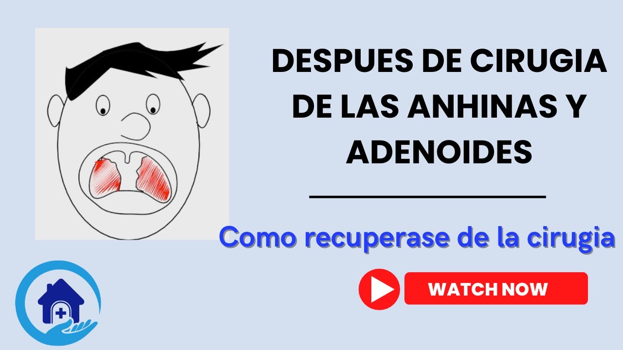 Despues De la Cirugia De Las Anhinas y Adenoides:  Como mejor recuperarse
