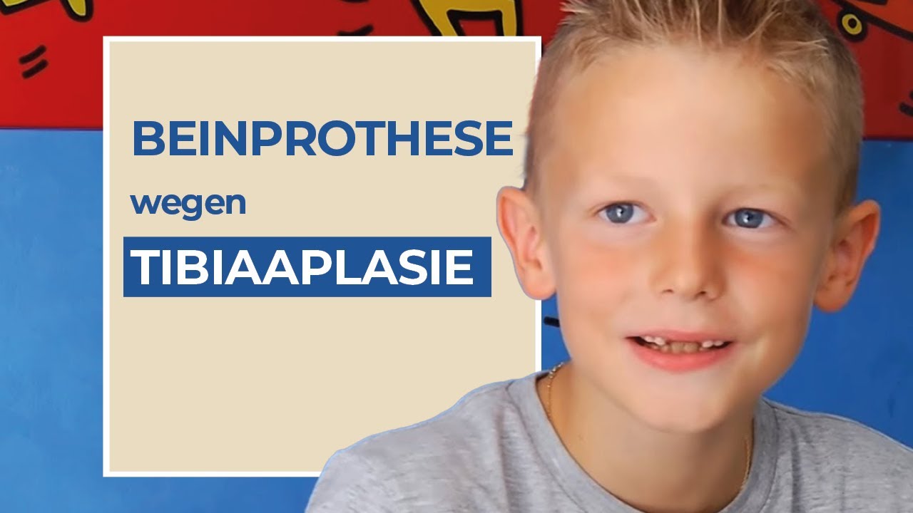 Moritz' Weg mit Tibiaaplasie (Dysmelie): Orthoprothese, Knieex-Prothese, Badeprothese