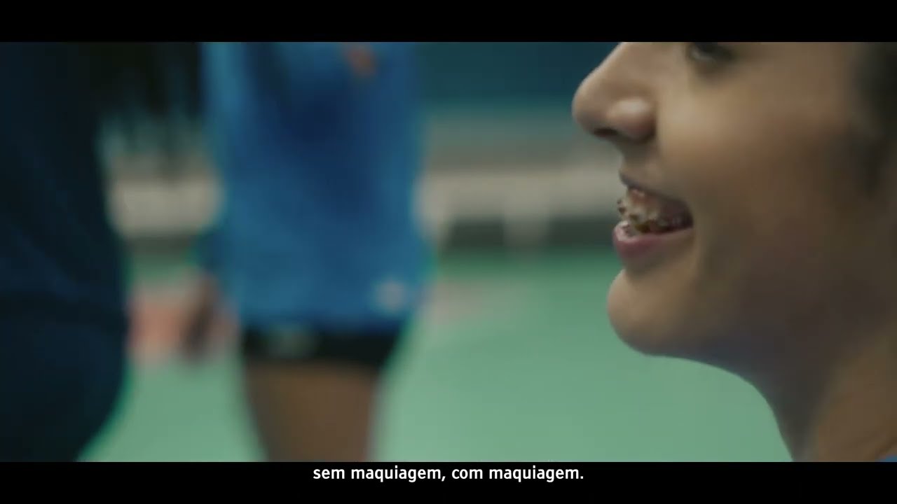 Como a Cirurgia Ortognática transformou a vida de Diana Duarte e melhorou seu desempenho no vôlei