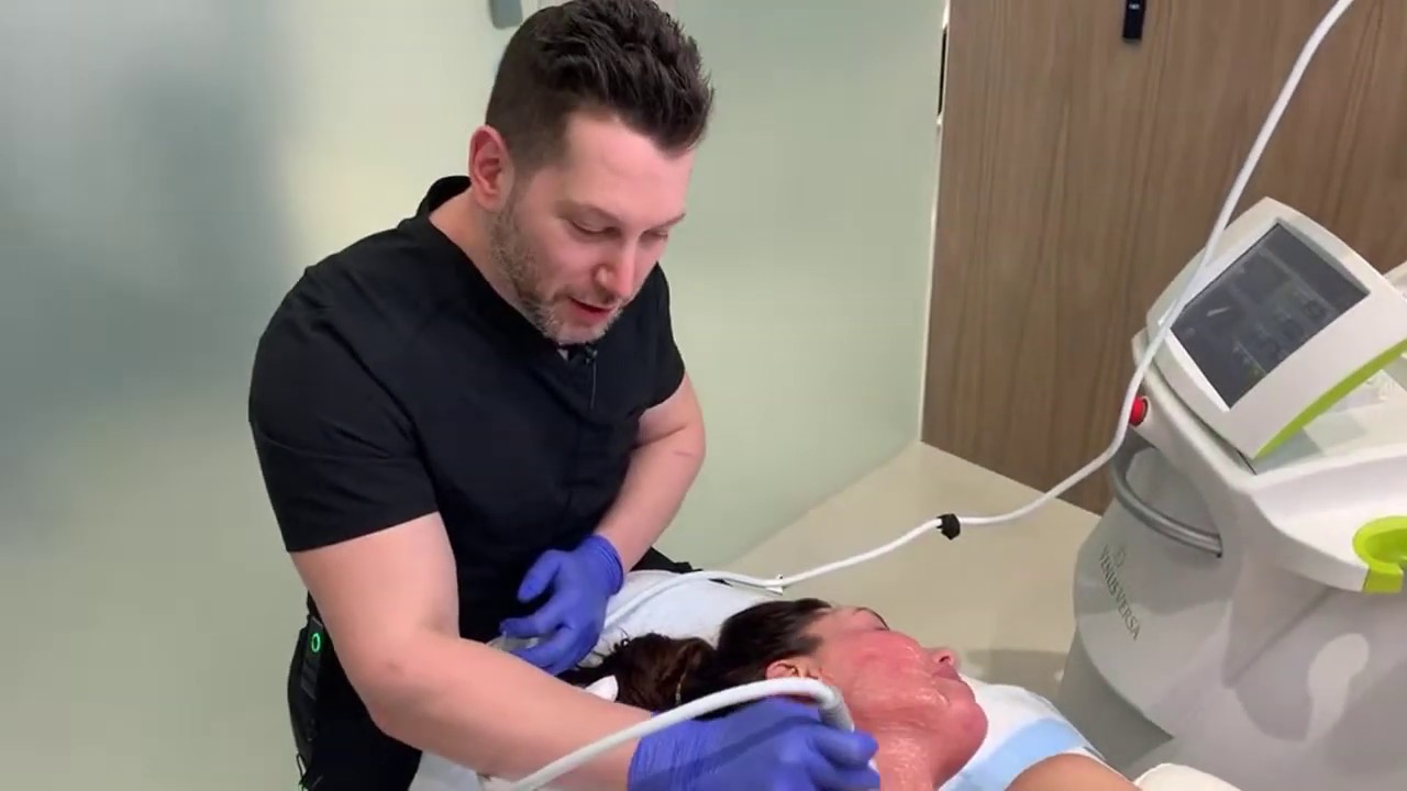 Venus Legacy | Lower Face and Neck Skin Tightening | West Hollywood, CA | Dr. Jason Emer