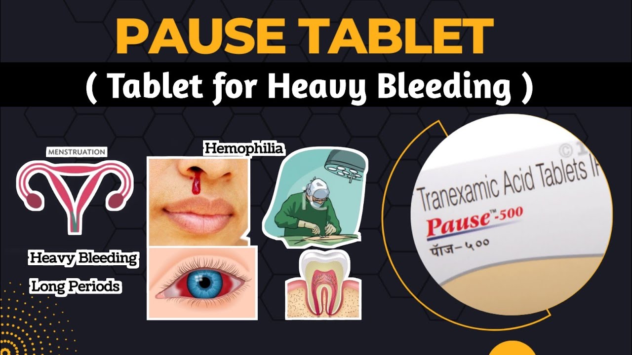 Pause Tablet ( Tablets for Abnormal Bleeding) Uses and Side Effects
