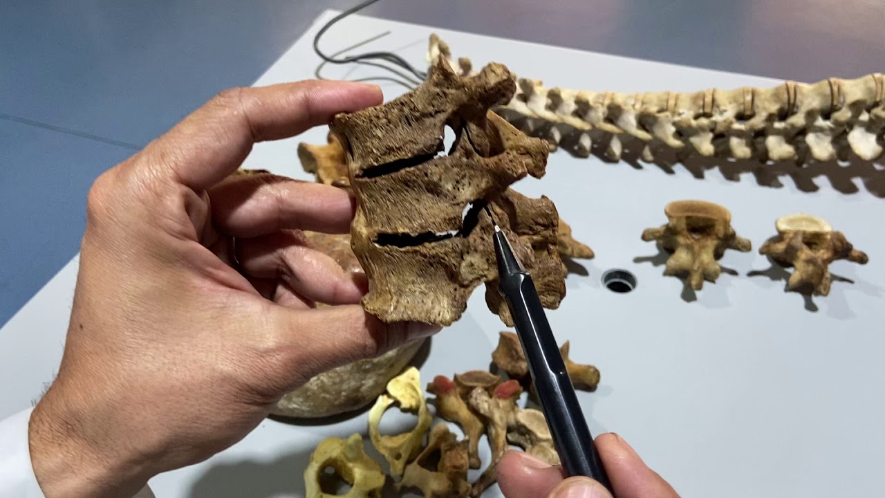 ARTROLOGÍA DE LA COLUMNA VERTEBRAL